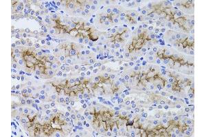 Immunohistochemistry of paraffin-embedded rat kidney using GGT1 antibody (ABIN1872809) at dilution of 1:100 (40x lens).