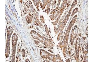 IHC-P Image Immunohistochemical analysis of paraffin-embedded human colon , using NDUFA10, antibody at 1:100 dilution. (NDUFA10 Antikörper  (Center))