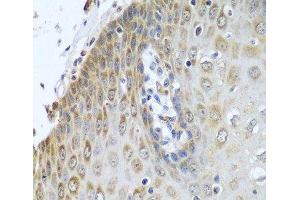 Immunohistochemistry of paraffin-embedded Human esophagus using POR Polyclonal Antibody at dilution of 1:100 (40x lens). (POR Antikörper)