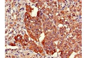 Immunohistochemistry of paraffin-embedded human adrenal gland tissue using ABIN7164525 at dilution of 1:100 (EARS2 Antikörper  (AA 42-166))