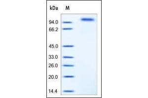 Mouse EGF R, His Tag on SDS-PAGE under reducing (R) condition. (EGFR Protein (AA 25-647) (His tag))