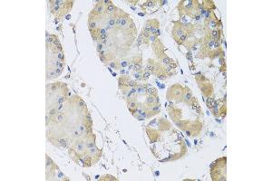 Immunohistochemistry of paraffin-embedded human gastric using RPLP1 antibody at dilution of 1:100 (x40 lens). (RPLP1 Antikörper)