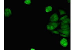 Immunofluorescent analysis of MCF-7 cells using ABIN7170794 at dilution of 1:100 and Alexa Fluor 488-congugated AffiniPure Goat Anti-Rabbit IgG(H+L) (STING/TMEM173 Antikörper  (AA 207-379))