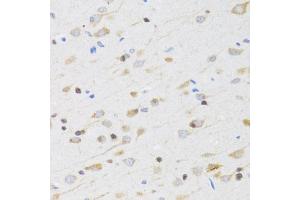 Immunohistochemistry of paraffin-embedded rat brain using CHRM5 antibody (ABIN1876555) at dilution of 1:100 (40x lens).