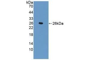 Detection of Recombinant TAGLN, Human using Polyclonal Antibody to Transgelin (TAGLN) (Transgelin Antikörper  (AA 1-201))