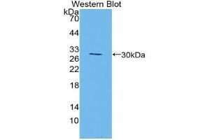 Western blot analysis of the recombinant protein. (Manic Fringe Antikörper  (AA 80-316))