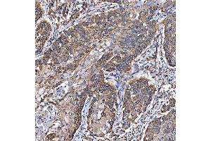 IHC analysis of SH2D4A using anti-SH2D4A antibody (ABIN7601695).