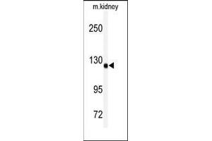 Western Blotting (WB) image for anti-ADAM Metallopeptidase with Thrombospondin Type 1 Motif, 19 (ADAMTS19) (Middle Region) antibody (ABIN359612)