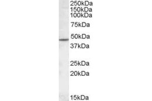Western Blotting (WB) image for anti-Cholinergic Receptor, Nicotinic, beta 2 (Neuronal) (CHRNB2) (Internal Region) antibody (ABIN308406)