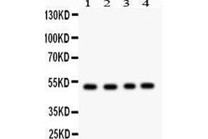 Western Blotting (WB) image for anti-Suppressor of Cytokine Signaling 4 (SOCS4) (AA 291-440) antibody (ABIN3043346)
