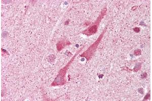 Anti-SHISA9 antibody IHC staining of human brain, cortex. (Shisa9 Antikörper  (Internal Region))