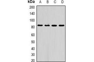 Western blot analysis of AFAP1 expression in A549 (A), HepG2 (B), mouse liver (C), rat liver (D) whole cell lysates. (AFAP Antikörper)
