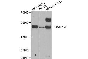 Western blot analysis of extracts of various cell lines, using CAMK2B antibody (ABIN5971341) at 1/1000 dilution. (CAMK2B Antikörper)