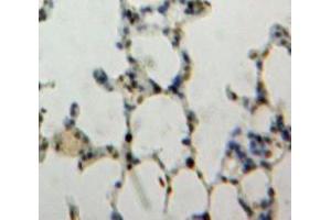 IHC-P analysis of Lung tissue, with DAB staining. (NUP88 Antikörper  (AA 159-422))