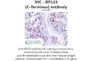 Image no. 2 for anti-Ribosomal Protein L22 (RPL22) (C-Term) antibody (ABIN1738940)