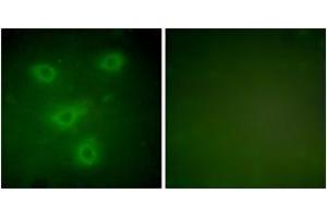 Immunofluorescence analysis of NIH-3T3 cells, using Keratin 14 Antibody. (KRT14 Antikörper  (AA 1-50))