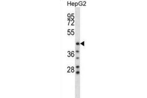 Western Blotting (WB) image for anti-Hyaluronidase-1 (HYAL1) antibody (ABIN2998320)