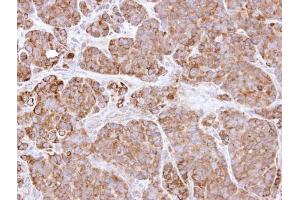 Immunohistochemistry (IHC) image for anti-BCL2-Like 1 (BCL2L1) antibody (ABIN2856151)