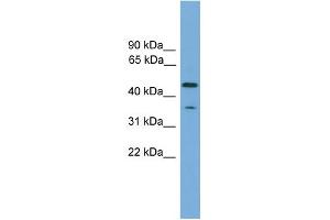WB Suggested Anti-C6orf154 Antibody Titration: 0. (C6orf154 Antikörper  (N-Term))