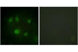 Immunofluorescence analysis of HeLa cells, using DDX5/DEAD-box Protein 5 (Ab-593) Antibody. (DDX5 Antikörper  (AA 565-614))