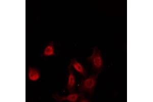 Immunofluorescence (fixed cells) (IF/ICC) image for anti-Kv Channel Interacting Protein 3, Calsenilin (KCNIP3) (Internal Region) antibody (ABIN6260422)