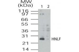 Image no. 1 for anti-Transmembrane Emp24 Protein Transport Domain Containing 4 (TMED4) (AA 55-67) antibody (ABIN208712)