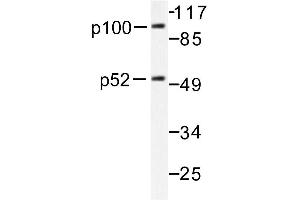 Image no. 1 for anti-Nuclear Factor of kappa Light Polypeptide Gene Enhancer in B-Cells 2 (NFKB2) antibody (ABIN271741) (NFKB2 Antikörper)
