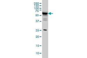 Western Blotting (WB) image for anti-DEAD (Asp-Glu-Ala-Asp) Box Polypeptide 56 (DDX56) (AA 450-548) antibody (ABIN599259) (DDX56 Antikörper  (AA 450-548))