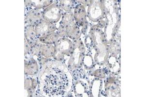 Immunohistochemical staining of human kidney with C1orf210 polyclonal antibody  shows nucleolar positivity in renal tubules. (C1ORF210 Antikörper)