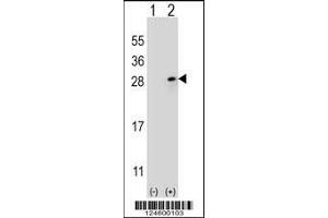 Western blot analysis of FGF9 using rabbit polyclonal FGF9 Antibody using 293 cell lysates (2 ug/lane) either nontransfected (Lane 1) or transiently transfected (Lane 2) with the FGF9 gene. (FGF9 Antikörper  (N-Term))