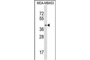Western blot analysis in MDA-MB453 cell line lysates (35ug/lane). (PSG9 Antikörper  (AA 111-139))