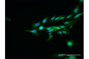 Immunofluorescence of purified MaxPab antibody to DCPS on HeLa cell. (DCPS Antikörper  (AA 1-337))