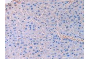 IHC-P analysis of Mouse Liver Tissue, with DAB staining. (UCN3 Antikörper  (AA 24-149))