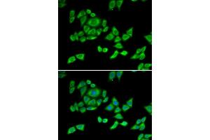 Immunofluorescence analysis of U2OS cells using OGDH antibody (ABIN6131413, ABIN6145002, ABIN6145004 and ABIN6216119). (alpha KGDHC Antikörper  (AA 148-427))
