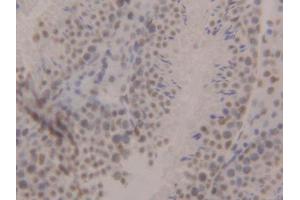 DAB staining on IHC-P; Samples: Mouse Testis Tissue (CBX3 Antikörper  (AA 1-183))