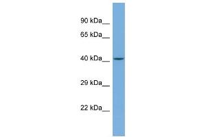 Host:  Rabbit  Target Name:  TRIM49C  Sample Type:  Jurkat Whole cell lysates  Antibody Dilution:  1. (TRIM49C Antikörper  (N-Term))