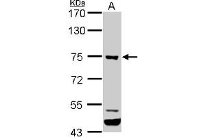 WB Image ELMO1 antibody [C3], C-term detects ELMO1 protein by western blot analysis. (ELMO1 Antikörper  (C-Term))
