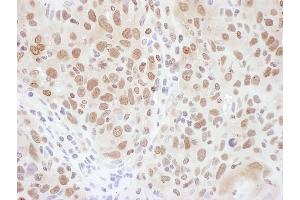 Immunohistochemistry (IHC) image for anti-Ring Finger Protein 20 (RNF20) (AA 125-175) antibody (ABIN7454669) (RNF20 Antikörper  (AA 125-175))
