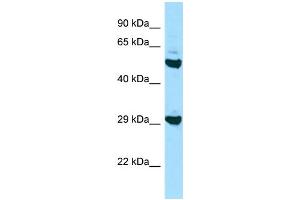 Western Blotting (WB) image for anti-Major Histocompatibility Complex, Class II, DO beta (HLA-DOB) (N-Term) antibody (ABIN2435823) (HLA-DOB Antikörper  (N-Term))