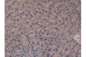 IHC-P analysis of Rat Liver Tissue, with DAB staining. (Meprin B Antikörper  (AA 433-679))