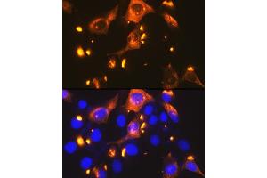 Immunofluorescence analysis of NIH-3T3 cells using GLUT2/SLC2 Rabbit mAb (ABIN7270414) at dilution of 1:100 (40x lens). (SLC2A2 Antikörper)