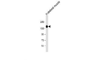 Western Blot at 1:8000 dilution + human skeletal muscle lysate Lysates/proteins at 20 ug per lane. (AGL Antikörper  (C-Term))