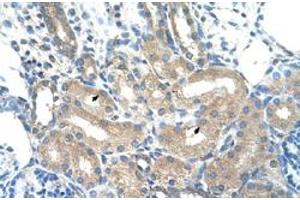 Immunohistochemical staining (Formalin-fixed paraffin-embedded sections) of human kidney with ADH1B polyclonal antibody  at 4-8 ug/mL working concentration. (ADH1B Antikörper  (C-Term))
