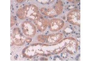 IHC-P analysis of Human Kidney Tissue, with DAB staining. (ATP6AP2 Antikörper  (AA 17-302))