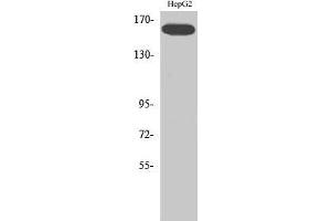 Western Blot (WB) analysis of specific cells using Phospho-Flk-1 (Y1214) Polyclonal Antibody. (VEGFR2/CD309 Antikörper  (pTyr1214))