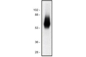 TRIM Antikörper  (Intracellular)