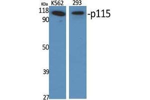 Western Blot (WB) analysis of specific cells using p115 Polyclonal Antibody. (ARHGAP4 Antikörper  (C-Term))