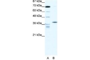 Western Blotting (WB) image for anti-Nuclear Receptor Subfamily 2, Group F, Member 6 (NR2F6) (N-Term) antibody (ABIN182517)