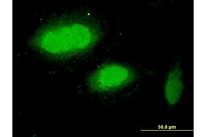 Immunofluorescence of monoclonal antibody to WDR79 on HeLa cell.