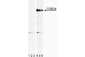 Western Blot analysis of Stat2 (pY690) in human histiocytic lymphoma.